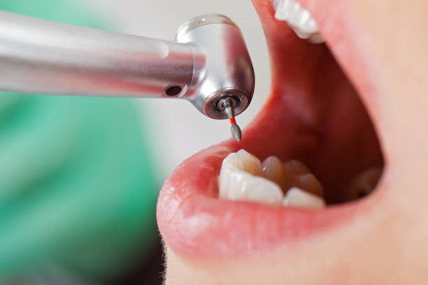 Best Emergency Root Canal Treatment in Highland Rk, PA